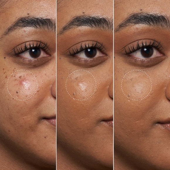 Fenty Beauty Blemish Defeat Cream - Picture 2 of 7